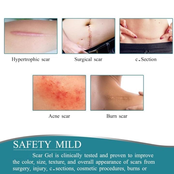 Scar Removal Sheet
