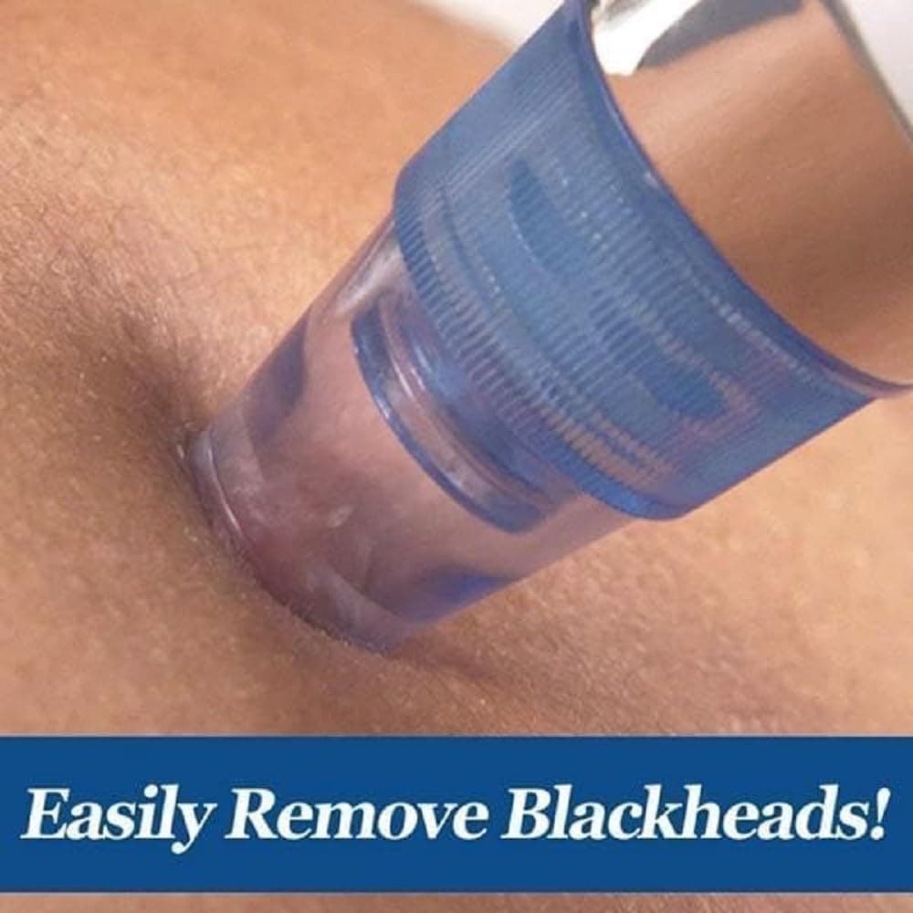 4-in-1 Blackhead Remover